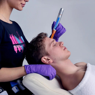 Bt- Titan "Microexfoliación"