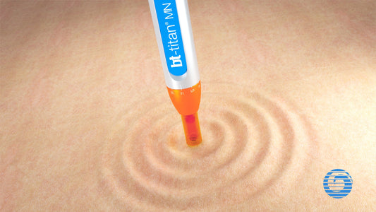 Bt- Titan "Microexfoliación"